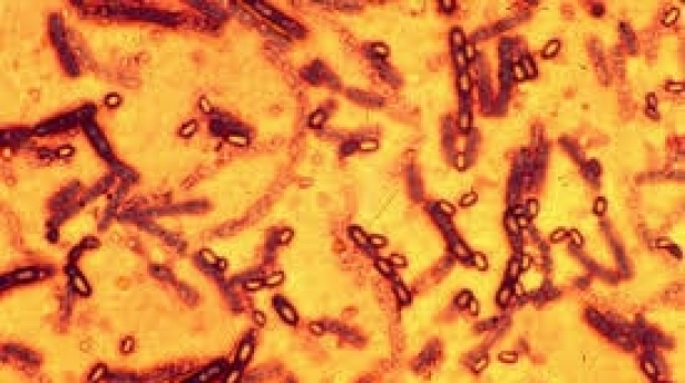 Analiza Bacillus anthracis - Antrax