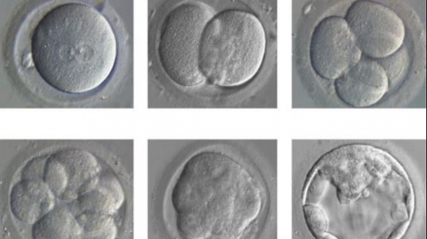 Cercetători au corectat gene defectuoase ale unor embrioni umani, o premieră mondială 