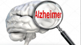 Boala Alzheimer va putea fi depistată printr-un test de sânge