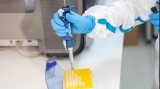 Testare pentru anticorpi