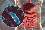 Bacteria Vibrio cholerae în intestinul subțire